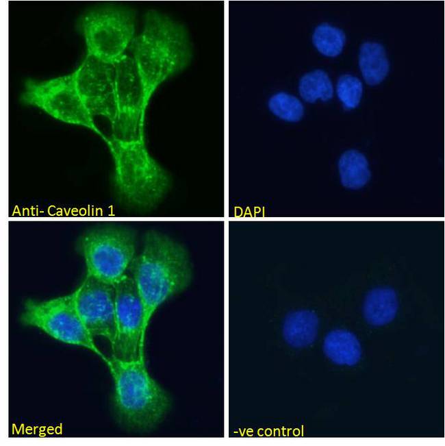 CAV1 / Caveolin 1 Antibody - CAV1 / Caveolin 1 antibody immunofluorescence analysis of paraformaldehyde fixed A431 cells, permeabilized with 0.15% Triton. Primary incubation 1hr (10ug/ml) followed by Alexa Fluor 488 secondary antibody (2ug/ml), showing Golgi and membrane staining. The nuclear stain is DAPI (blue). Negative control: Unimmunized goat IgG (10ug/ml) followed by Alexa Fluor 488 secondary antibody (2ug/ml).