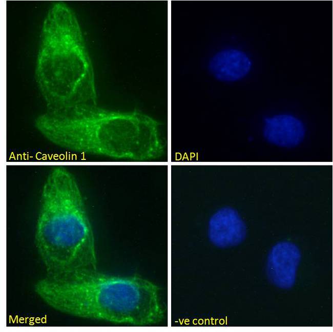 CAV1 / Caveolin 1 Antibody - CAV1 / Caveolin 1 antibody immunofluorescence analysis of paraformaldehyde fixed U2OS cells, permeabilized with 0.15% Triton. Primary incubation 1hr (10ug/ml) followed by Alexa Fluor 488 secondary antibody (2ug/ml), showing Golgi and cytoplasmic staining. The nuclear stain is DAPI (blue). Negative control: Unimmunized goat IgG (10ug/ml) followed by Alexa Fluor 488 secondary antibody (2ug/ml).