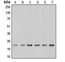 CAV1 / Caveolin 1 Antibody - Western blot analysis of Caveolin 1 expression in A549 (A); A431 (B); NIH3T3 (C); mouse kidney (D); rat kidney (E); rat heart (F) whole cell lysates.