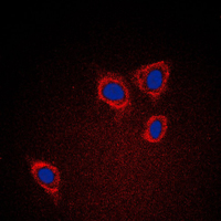 CAV1 / Caveolin 1 Antibody - Immunofluorescent analysis of Caveolin 1 staining in A431 cells. Formalin-fixed cells were permeabilized with 0.1% Triton X-100 in TBS for 5-10 minutes and blocked with 3% BSA-PBS for 30 minutes at room temperature. Cells were probed with the primary antibody in 3% BSA-PBS and incubated overnight at 4 C in a humidified chamber. Cells were washed with PBST and incubated with a DyLight 594-conjugated secondary antibody (red) in PBS at room temperature in the dark. DAPI was used to stain the cell nuclei (blue).