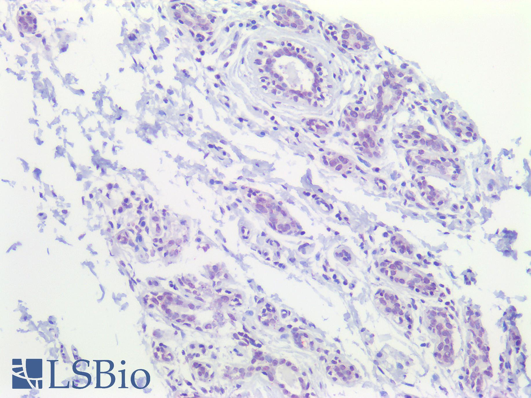 CBFA1 / RUNX2 Antibody - Human Breast: Formalin-Fixed, Paraffin-Embedded (FFPE)