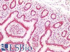 CBX3 / HP1 Gamma Antibody - Human Small Intestine: Formalin-Fixed, Paraffin-Embedded (FFPE)