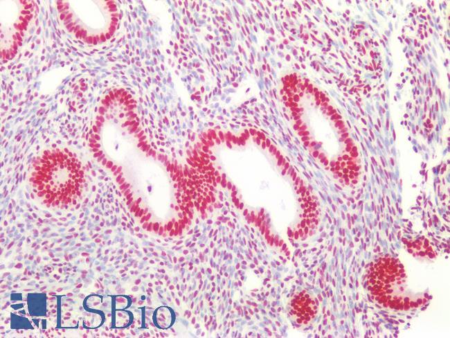 CBX3 / HP1 Gamma Antibody - Human Uterus: Formalin-Fixed, Paraffin-Embedded (FFPE)