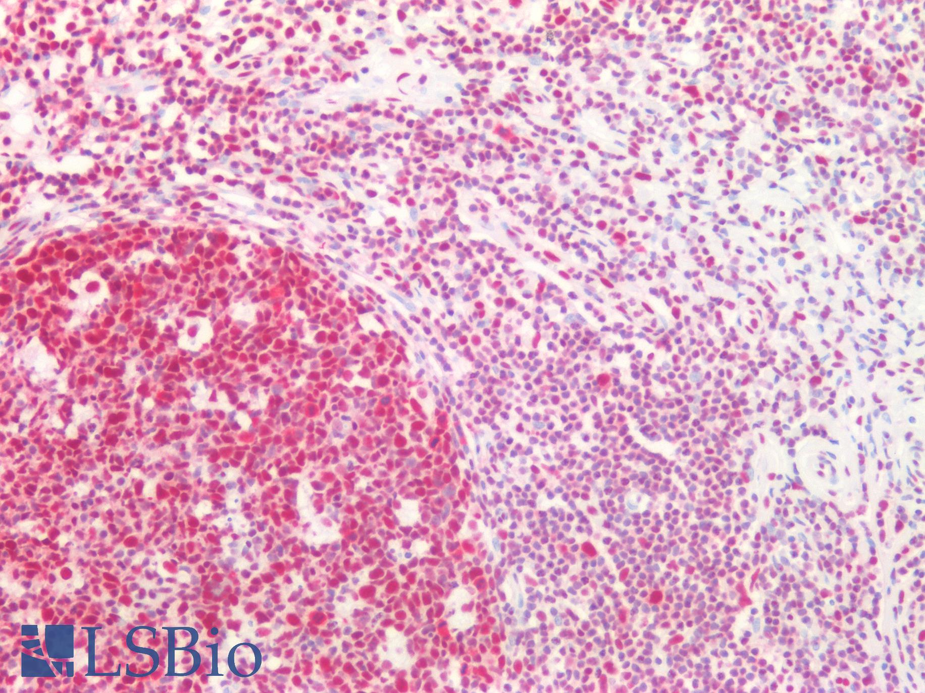 CBX3 / HP1 Gamma Antibody - Human Tonsil: Formalin-Fixed, Paraffin-Embedded (FFPE)