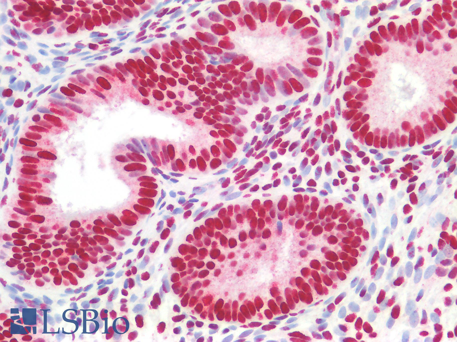 CBX5 / HP1 Alpha Antibody - Human Uterus: Formalin-Fixed, Paraffin-Embedded (FFPE)