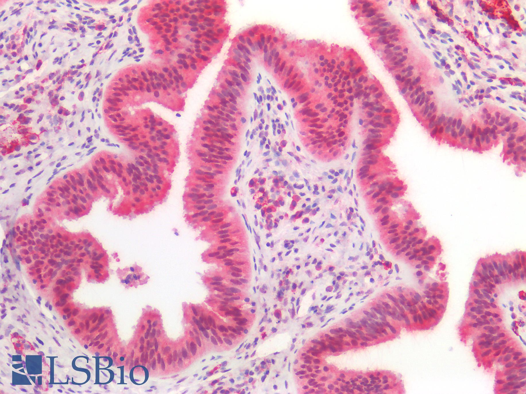 CCDC6 Antibody - Human Fallopian Tube: Formalin-Fixed, Paraffin-Embedded (FFPE)