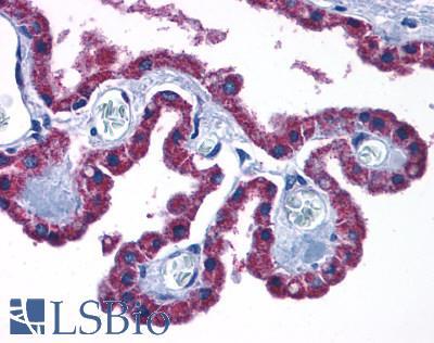 CCKBR / Cckb Antibody - Brain Hippocampus Adjacent Choroid Plexus Epithelium