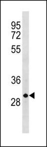 CCND3 / Cyclin D3 Antibody - CCND3 Antibody (C-term S274) western blot of MDA-MB231 cell line lysates (35 ug/lane). The CCND3 antibody detected the CCND3 protein (arrow).