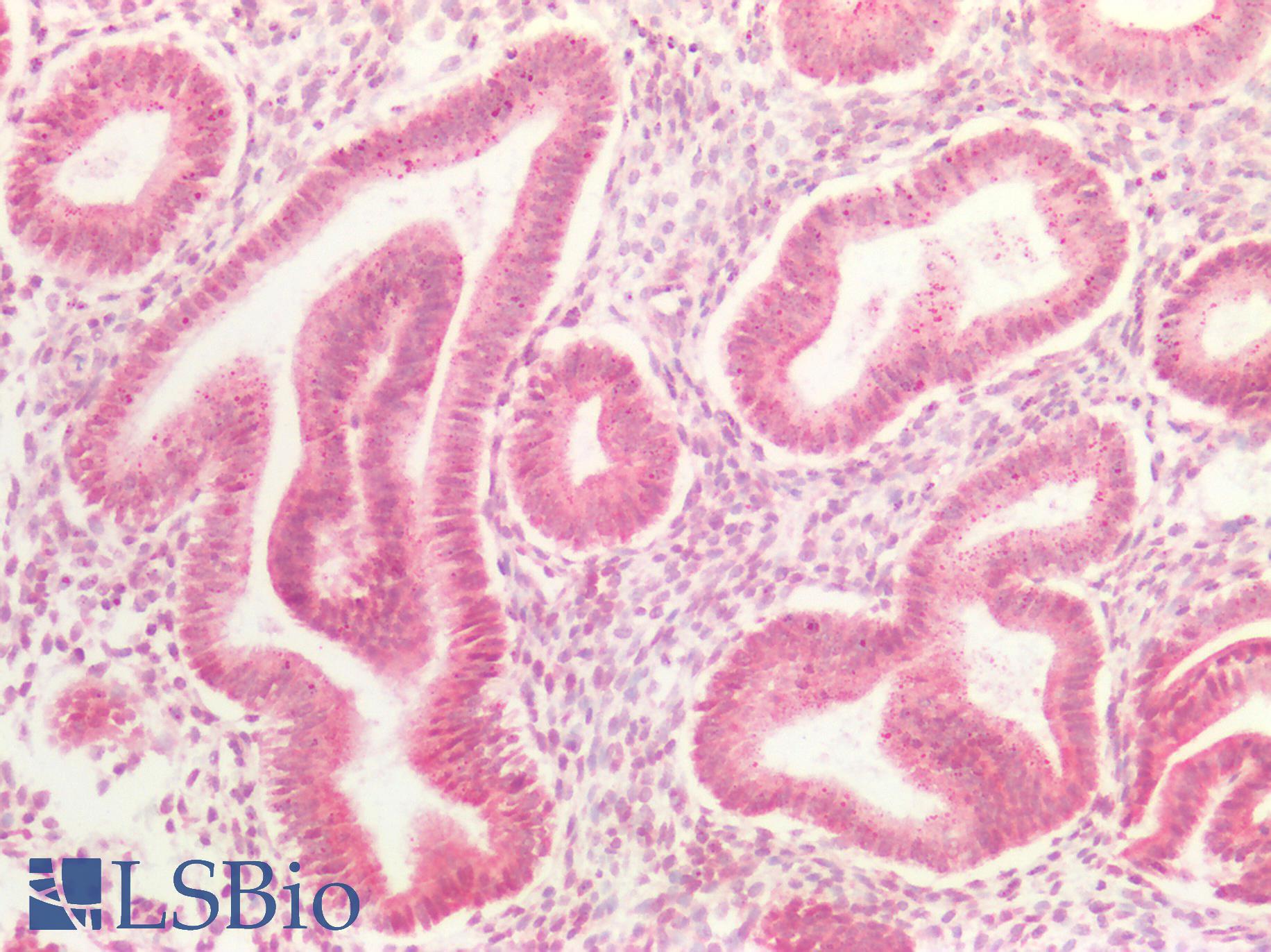 CCND3 / Cyclin D3 Antibody - Human Uterus: Formalin-Fixed, Paraffin-Embedded (FFPE)