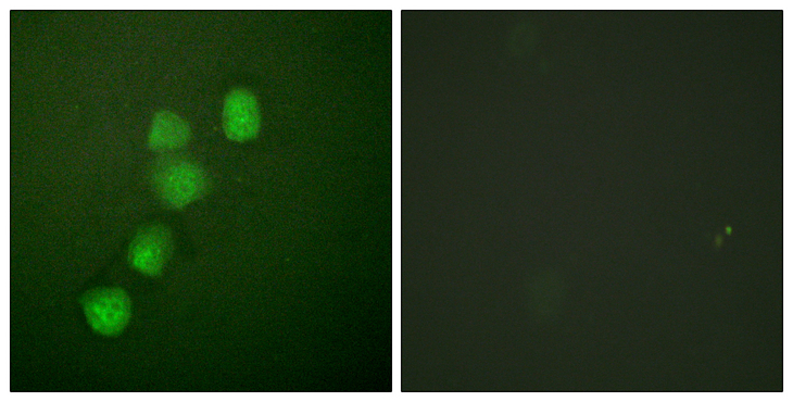CCNE1 / Cyclin E1 Antibody - Immunofluorescence analysis of HUVEC cells, using Cyclin E1 Antibody. The picture on the right is blocked with the synthesized peptide.