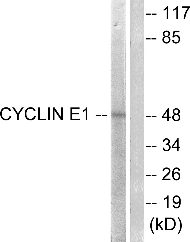 CCNE1 / Cyclin E1 Antibody - Western blot analysis of lysates from HeLa cells, treated with Paclitaxel 1uM 60', using Cyclin E1 Antibody. The lane on the right is blocked with the synthesized peptide.