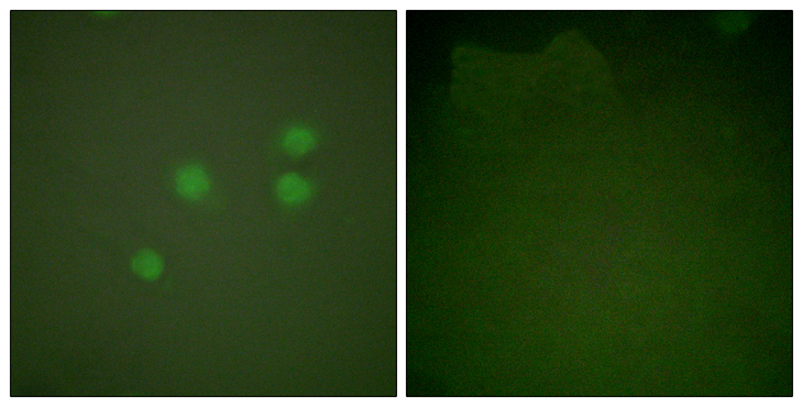 CCNE1 / Cyclin E1 Antibody - Immunofluorescence analysis of A549 cells, using Cyclin E1 Antibody. The picture on the right is blocked with the synthesized peptide.