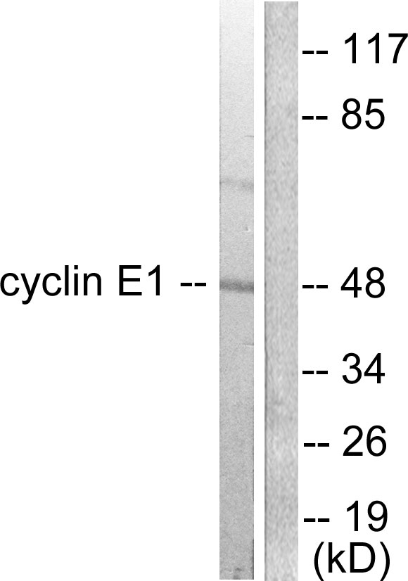 CCNE1 / Cyclin E1 Antibody - Western blot analysis of lysates from K562 cells, using Cyclin E1 Antibody. The lane on the right is blocked with the synthesized peptide.