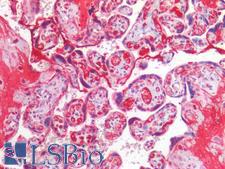CCNE1 / Cyclin E1 Antibody - Human Placenta: Formalin-Fixed, Paraffin-Embedded (FFPE)