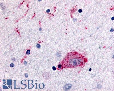 CCR1 Antibody - Brain Amygdala Neurons and Glia