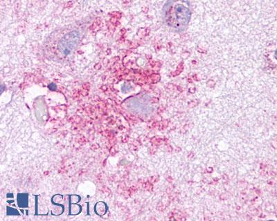 CCR3 Antibody - Brain, Alzheimer's disease, senile plaque