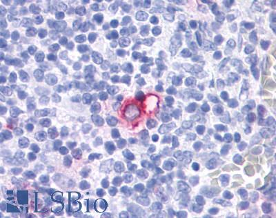 CCR4 Antibody - Thymus, dendritic cell
