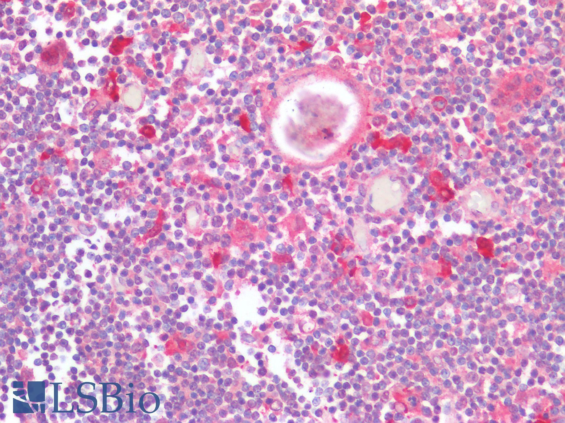 CCR5 Antibody - Human Thymus: Formalin-Fixed, Paraffin-Embedded (FFPE)