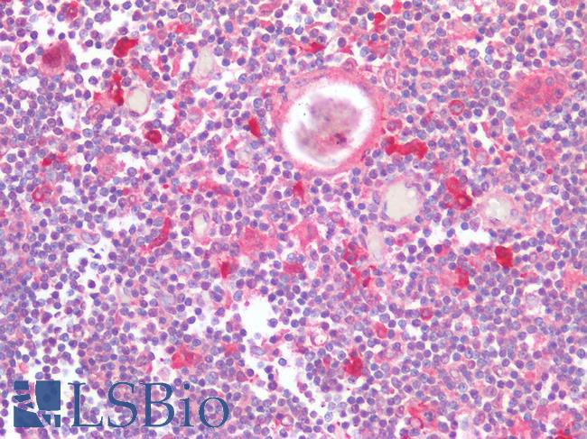 CCR5 Antibody - Human Thymus: Formalin-Fixed, Paraffin-Embedded (FFPE)