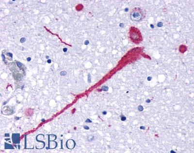 CCR7 Antibody - Brain Hypothalamus Neuron
