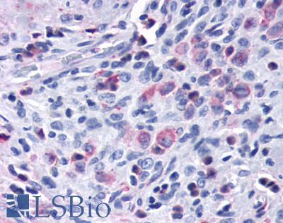 CCR7 Antibody - Lymph node, eosinophilic granuloma Langerhans histiocytes