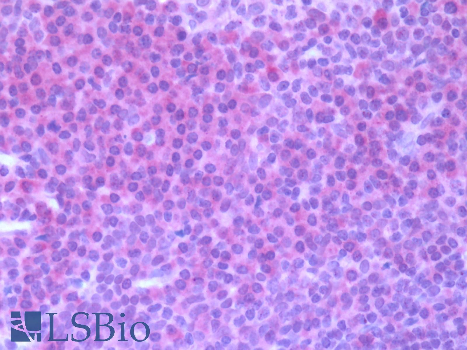 CCR7 Antibody - Human Tonsil: Formalin-Fixed, Paraffin-Embedded (FFPE)