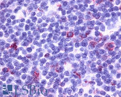 CCR7 Antibody - lymph node, Hodgkin's lymphoma