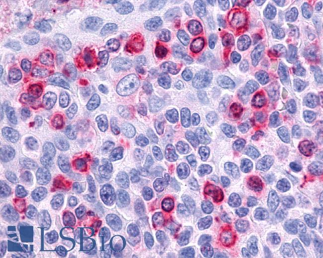 CCR7 Antibody - Anti-CCR7 antibody IHC staining of human tonsil, lymphocytes. Immunohistochemistry of formalin-fixed, paraffin-embedded tissue after heat-induced antigen retrieval.