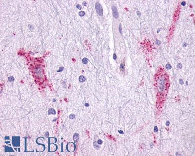 CCR9 / CD199 Antibody - Brain Amygdala Neurons and Glia