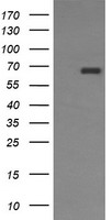 CD105 Antibody - Western blot analysis of Anti-CD105 antibody (LS-B9998; 5 µg of cell lysate per lane). Lane 1: HEK293T transfected with pCMV6-ENTRY control. Lane 2: HEK293T transfected with pCMV6-ENTRY CD105. Antibody produced band at ~70 kDa in CD105 transfected cell lysate and did not produce a band in the control lysate