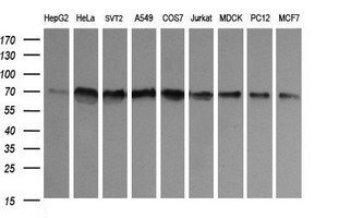 CD105 Antibody - Western blot analysis of Anti-CD105 antibody (LS-B9998; 35 µg of extract per lane). Lane 1: HepG2 cell line. Lane 2: HeLa cell line. Lane 3: SVT2 cell line. Lane 4: A549 cell line. Lane 5: COS7 cell line. Lane 6: Jurkat cell line. Lane 7: MDCK cell line. Lane 8: PC12 cell line. Lane 9: MCF7 cell line. Antibody produced band at ~70 kDa. 