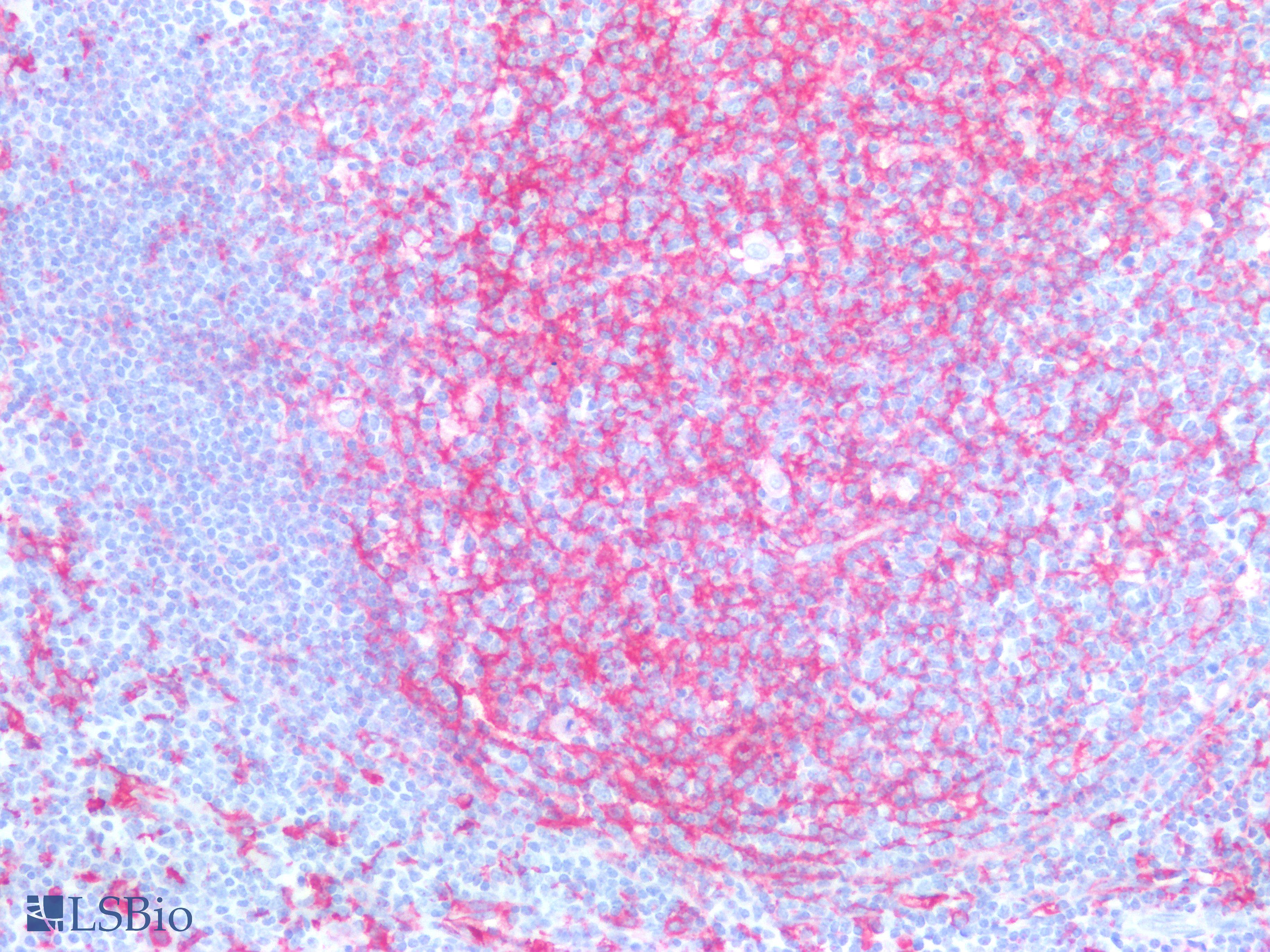 PathPlus™ CD14 Monoclonal Antibody Mouse anti-Human IHC | LSBio