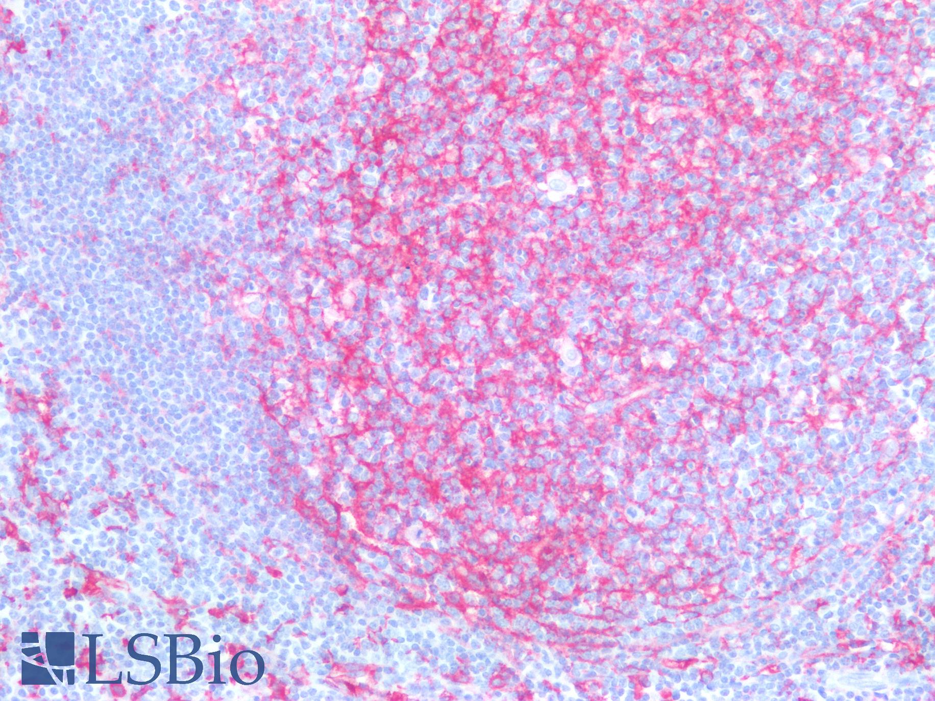 CD14 Antibody - Human Tonsil: Formalin-Fixed, Paraffin-Embedded (FFPE)