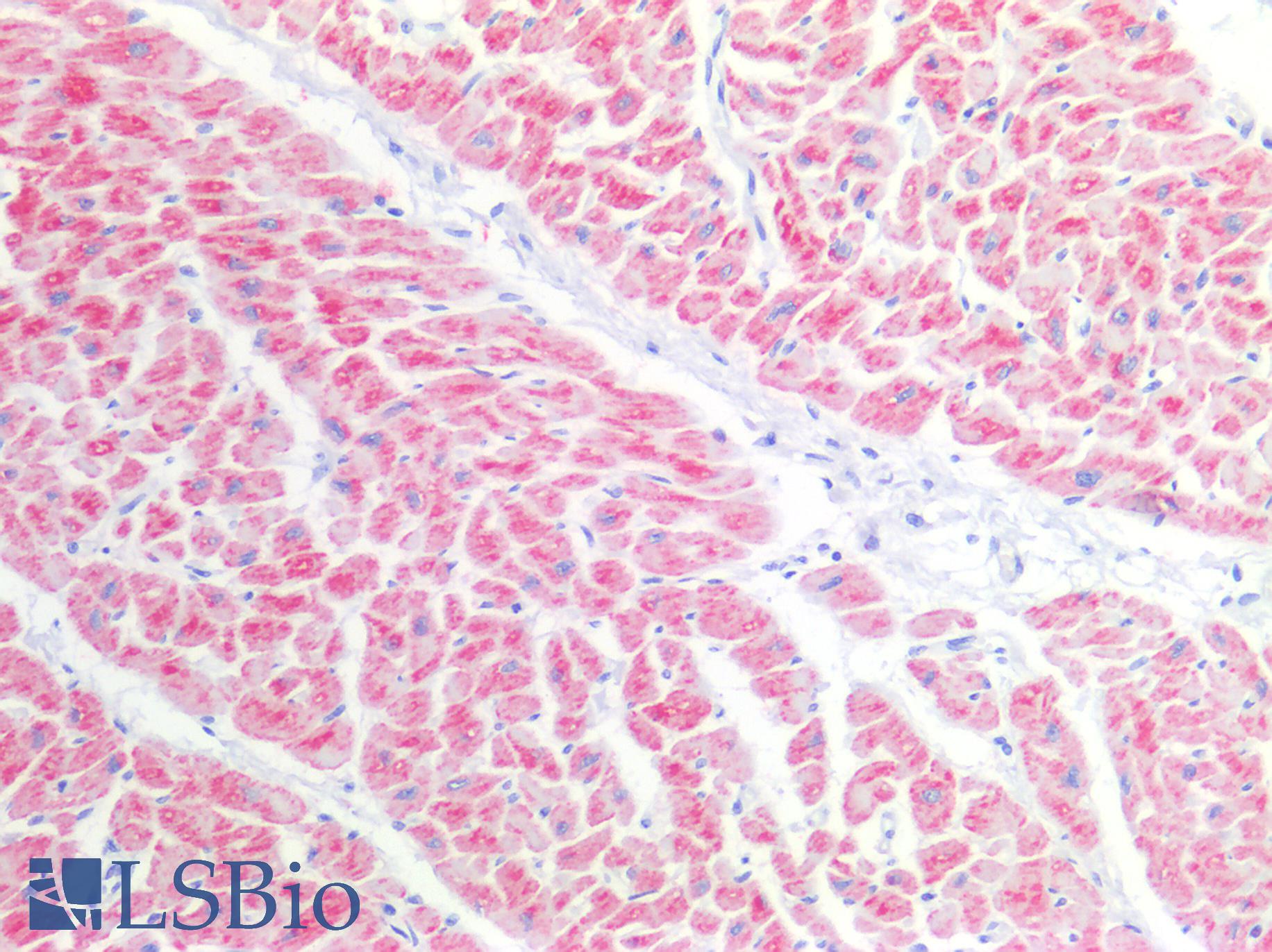 CD157 Antibody - Human Heart: Formalin-Fixed, Paraffin-Embedded (FFPE)