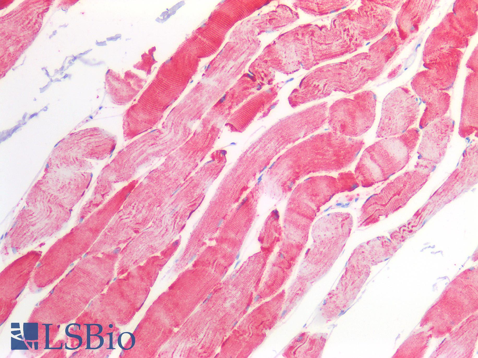 CD157 Antibody - Human Skeletal Muscle: Formalin-Fixed, Paraffin-Embedded (FFPE)