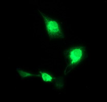 CD163 Antibody - Anti-CD163 mouse monoclonal antibody immunofluorescent staining of COS7 cells transiently transfected by pCMV6-ENTRY CD163.