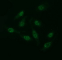 CD163 Antibody - Immunofluorescent staining of HeLa cells using anti-CD163 mouse monoclonal antibody.