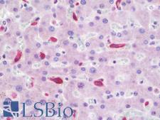 CD163 Antibody - Anti-CD163 antibody IHC staining of human liver. Immunohistochemistry of formalin-fixed, paraffin-embedded tissue after heat-induced antigen retrieval. Antibody concentration 10 ug/ml.