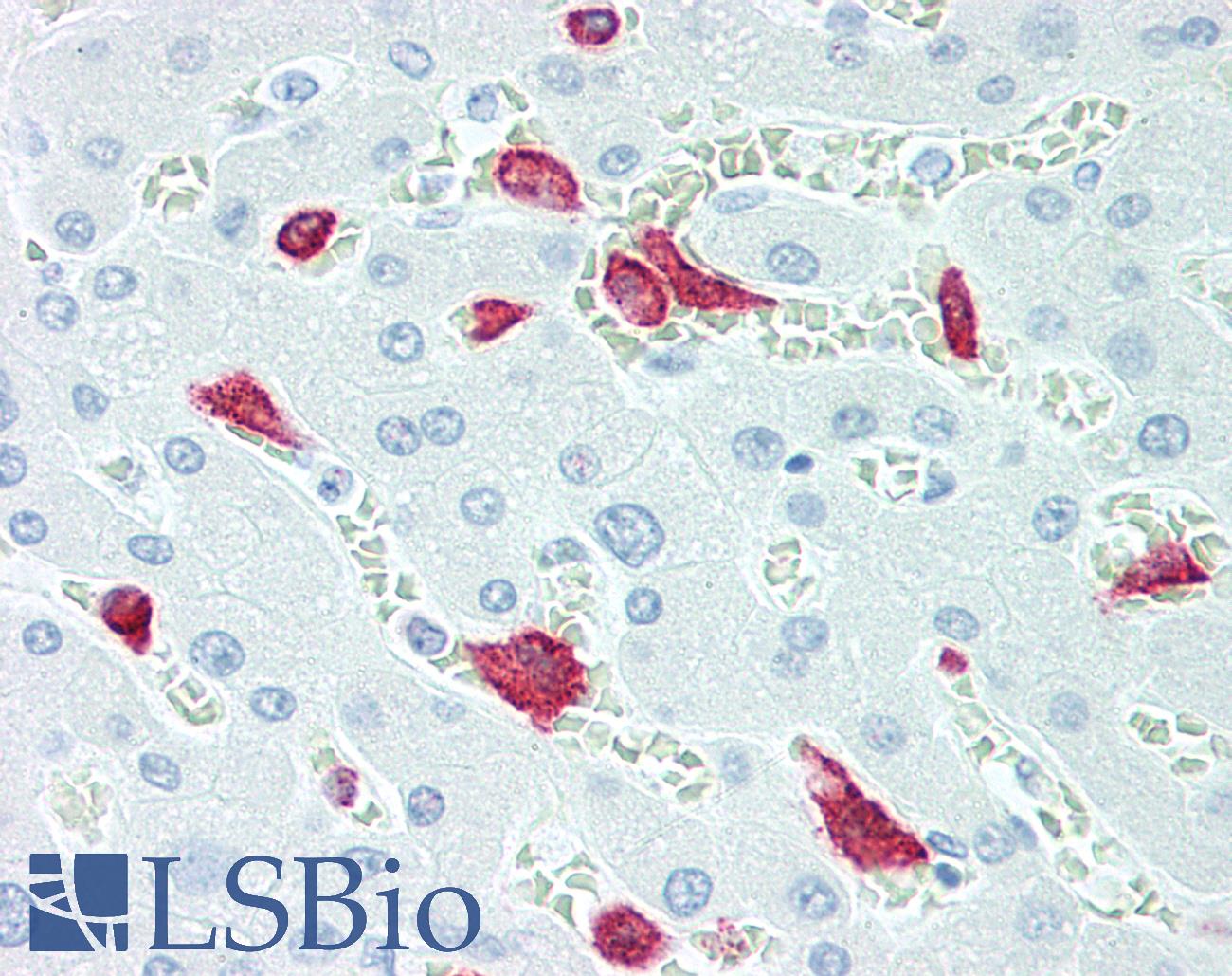 CD163 Antibody - Human Liver, Kupffer cells: Formalin-Fixed, Paraffin-Embedded (FFPE)
