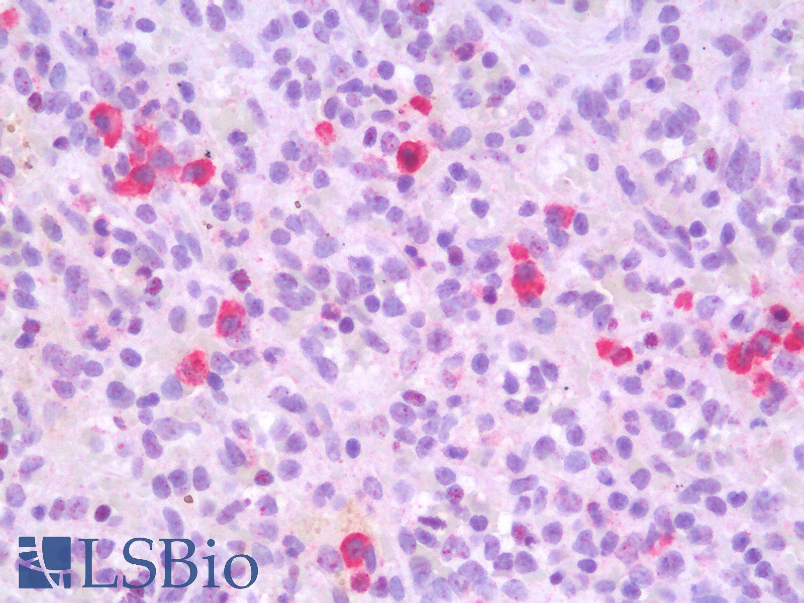 CD19 Antibody - Human Spleen: Formalin-Fixed, Paraffin-Embedded (FFPE)