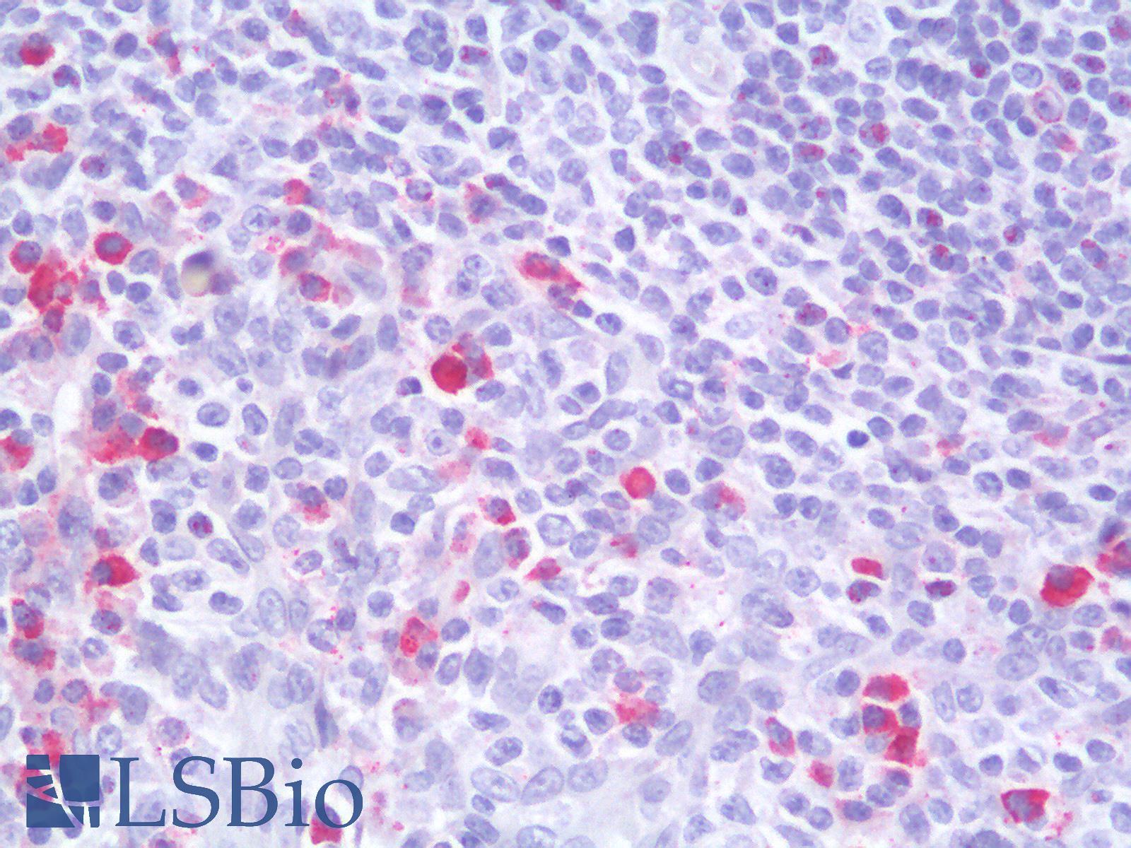 CD19 Antibody - Human Tonsil: Formalin-Fixed, Paraffin-Embedded (FFPE)