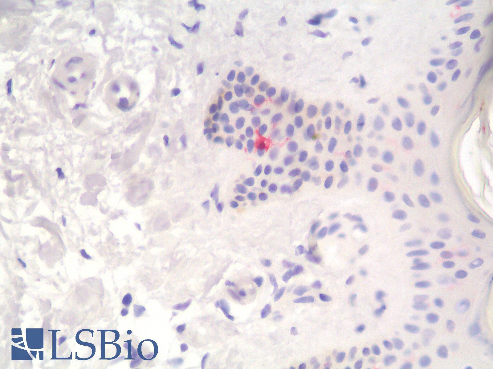 CD1A Antibody - Human Skin: Formalin-Fixed, Paraffin-Embedded (FFPE)