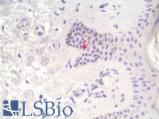 CD1A Antibody - Human Skin: Formalin-Fixed, Paraffin-Embedded (FFPE)
