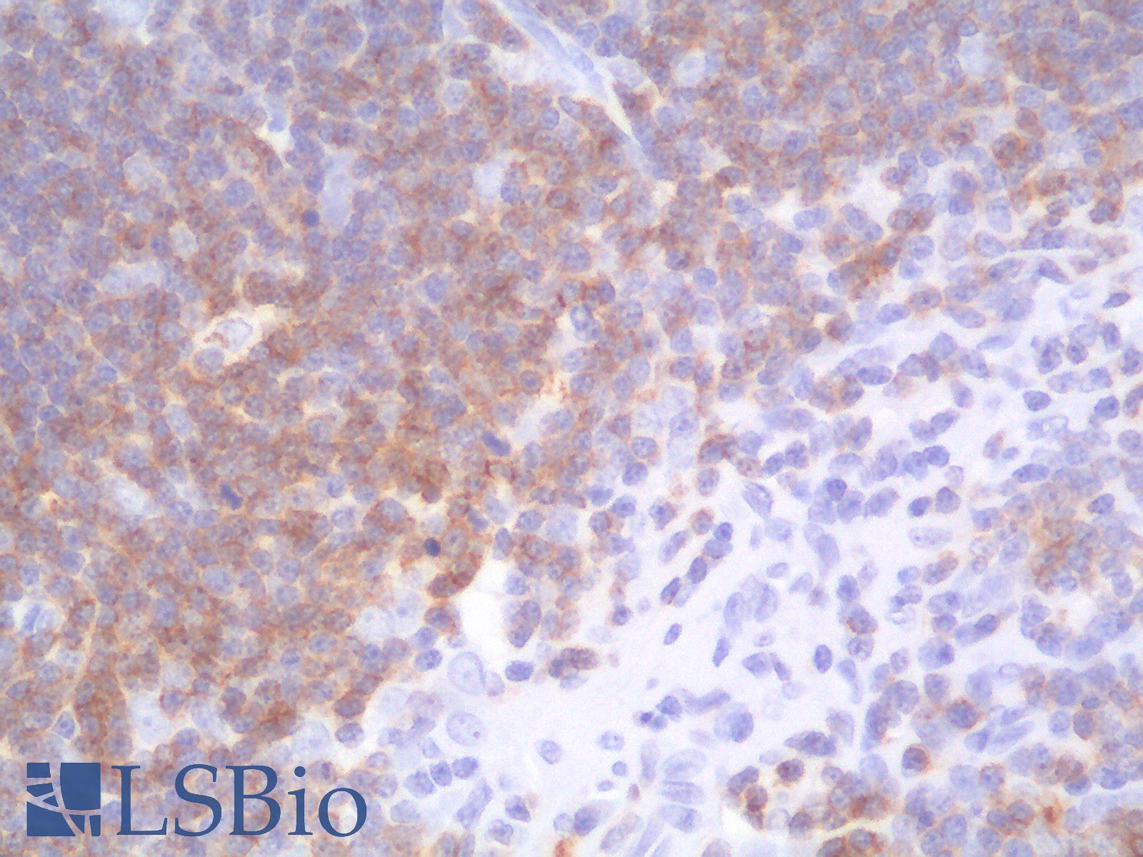 CD1A Antibody - Human Thymus: Formalin-Fixed, Paraffin-Embedded (FFPE)