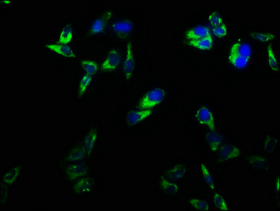 CD2 Antibody - Immunofluorescence staining of Hela cells with CD2 Antibody at 1:166, counter-stained with DAPI. The cells were fixed in 4% formaldehyde, permeabilized using 0.2% Triton X-100 and blocked in 10% normal Goat Serum. The cells were then incubated with the antibody overnight at 4°C. The secondary antibody was Alexa Fluor 488-congugated AffiniPure Goat Anti-Rabbit IgG(H+L).