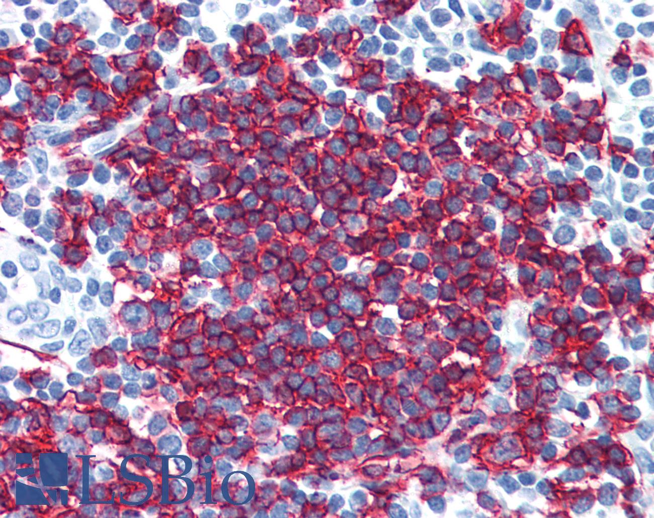CD20 Antibody - Anti-MS4A1 / CD20 antibody IHC of human tonsil. Immunohistochemistry of formalin-fixed, paraffin-embedded tissue after heat-induced antigen retrieval. Antibody concentration 10 ug/ml.