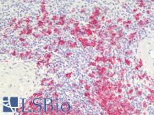 CD20 Antibody - Human Spleen: Formalin-Fixed, Paraffin-Embedded (FFPE)