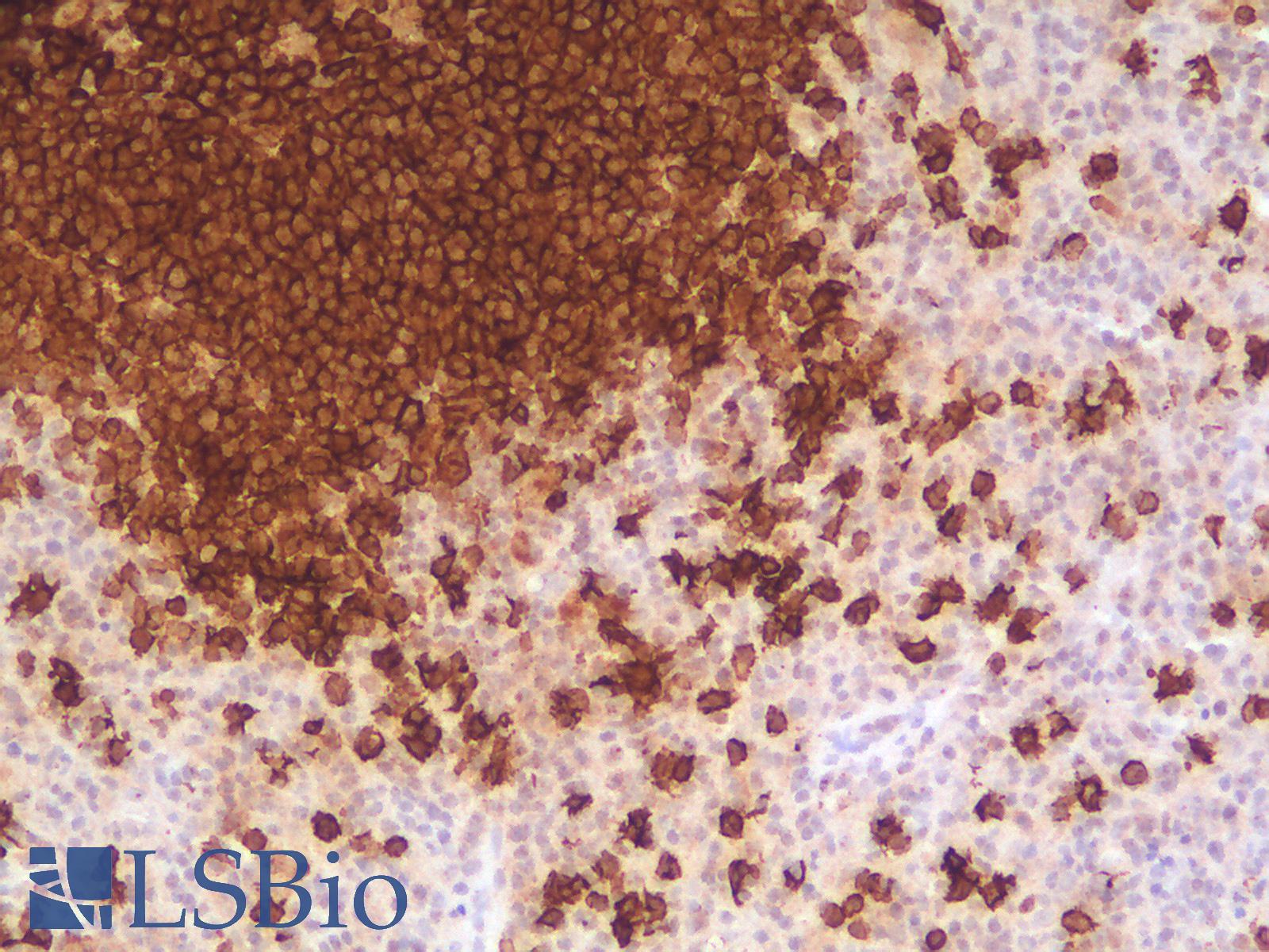CD20 Antibody - Human Spleen: Formalin-Fixed, Paraffin-Embedded (FFPE)
