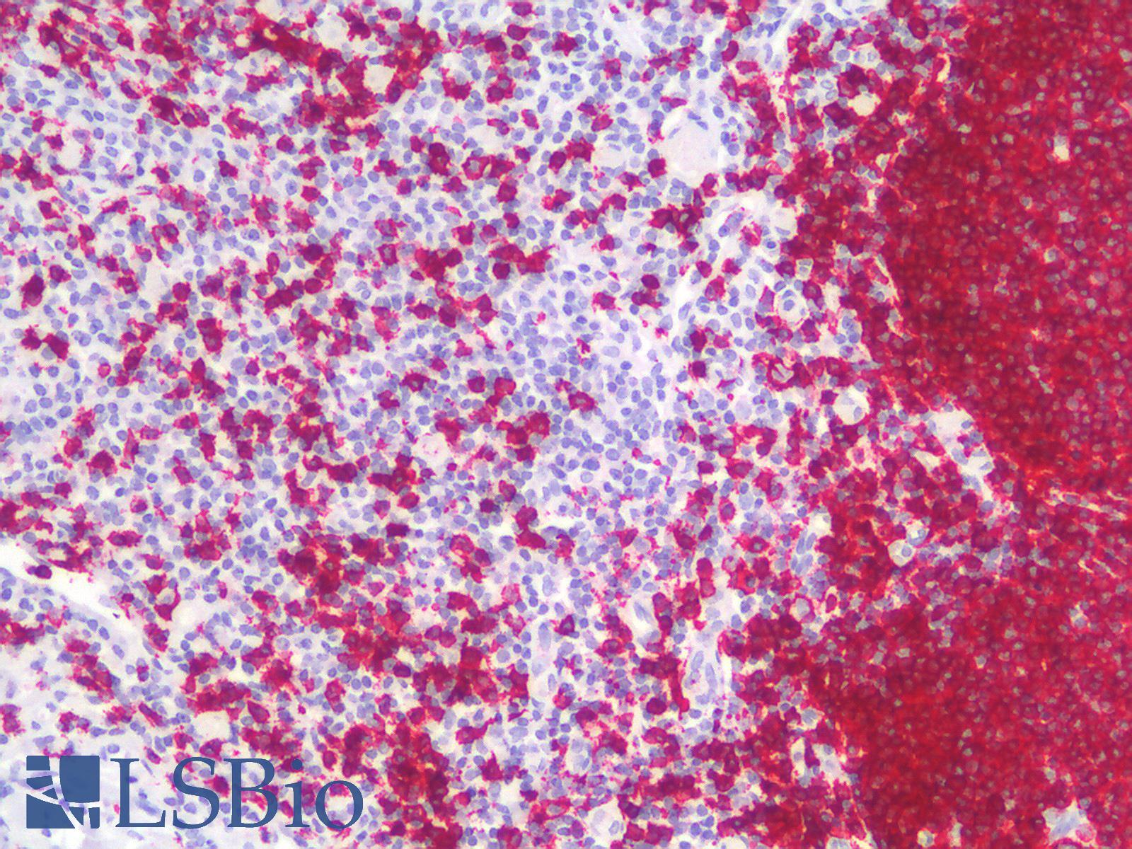 CD20 Antibody - Human Tonsil: Formalin-Fixed, Paraffin-Embedded (FFPE)