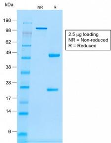 CD20 Antibody - SDS-PAGE Analysis Purified CD20 Mouse Recombinant Monoclonal Antibody (rIGEL/773). Confirmation of Purity and Integrity of Antibody.